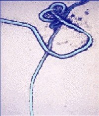 Ebola-Impfstoff geht in die klinische Testphase