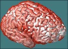 Das Glück sitzt im Gehirn: Neurowissenschaftler erforschen die biologischen Grundlagen
der Freude