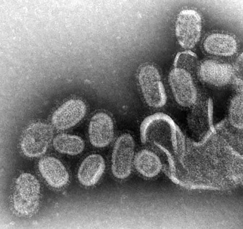 Influenza mag es kalt und trocken