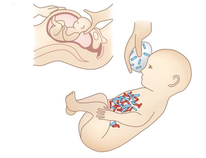 "Mütterliche Lotion" für Kaiserschnitt-Babys