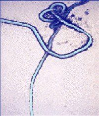 Ebola-Impfstoff geht in die klinische Testphase