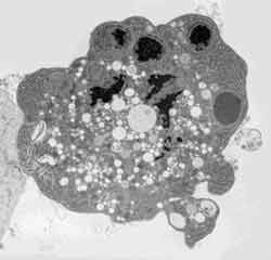 Apoptose-Story: Die zelluläre Kunst des Sterbens