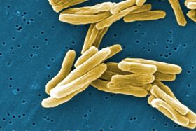 Tuberkulose: Treuer Begleiter seit 70.000 Jahren