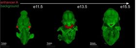 Genetisches Feintuning fürs Gesicht