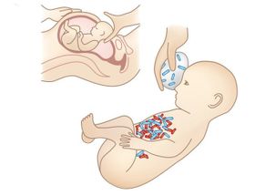 "Mütterliche Lotion" für Kaiserschnitt-Babys